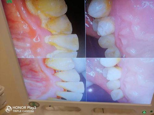 济南历下百可瑞口腔诊所口碑评价