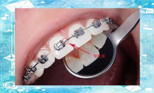 福建龙岩卢四珍口腔擅长项目：