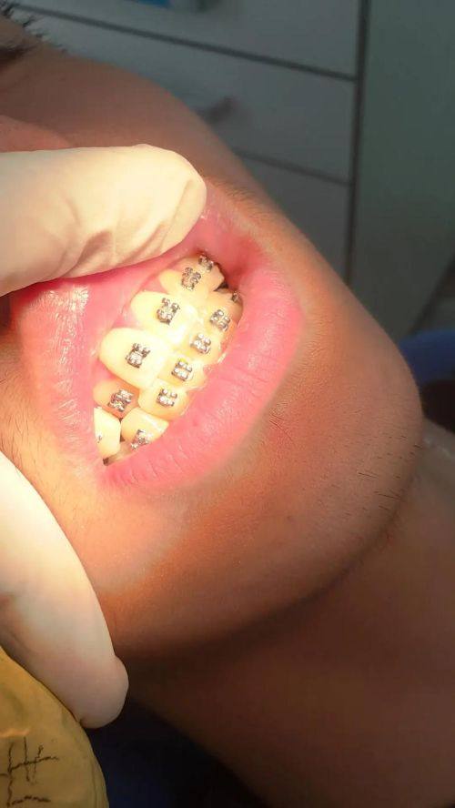 福建龙岩卢四珍口腔口碑评价：