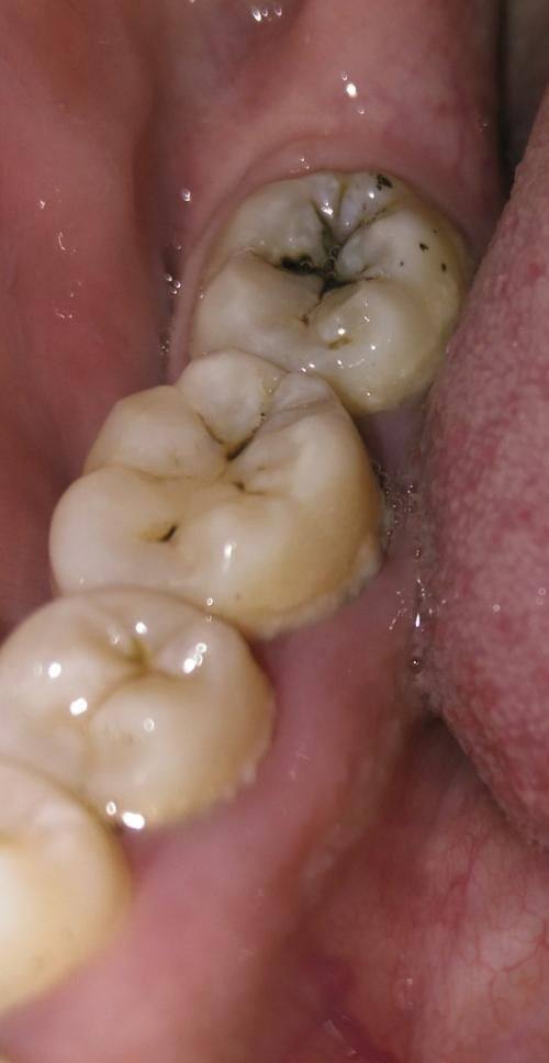 广东佛山拓美口腔门诊部价格表：