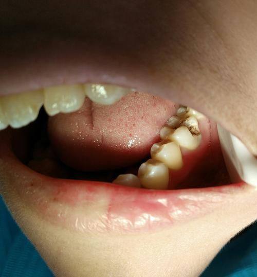 广东揭阳普宁普大口腔擅长项目：