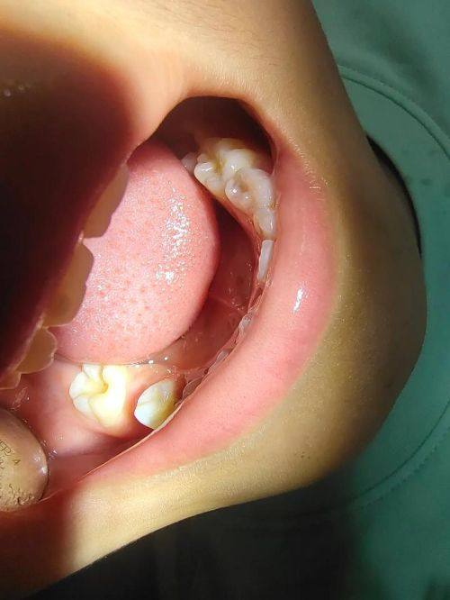 云南丽江锦美口腔怎么样?