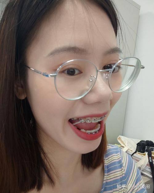 哈尔滨展颜口腔门诊部擅长项目：