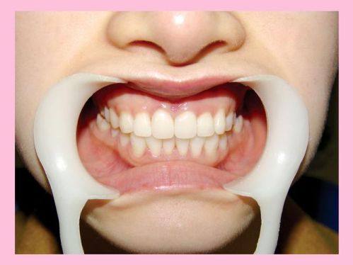 北京益贝佳口腔诊所价格表