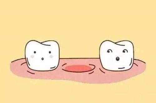 二、根据地包天类型，37岁矫正需选对应方案