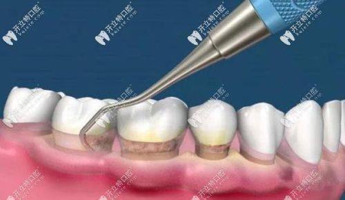 高新新桥口腔门诊部怎么样？