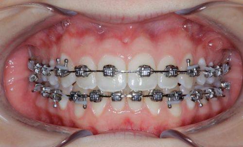 长沙齿奥口腔价格表