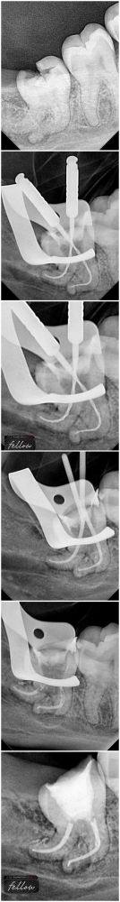 温州艺星口腔擅长项目：