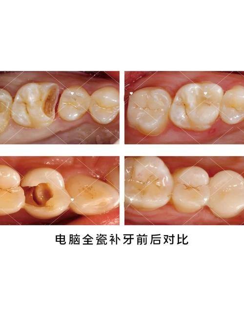 兴安盟蒙医院口腔科地址电话及营业时间
