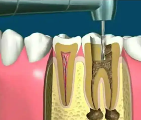 江苏镇江皓雅口腔诊所价格表：