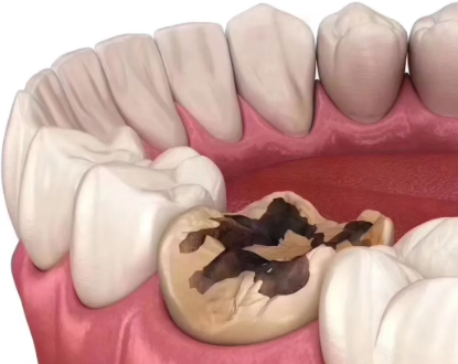 太和县李怀业口腔门诊部擅长项目: