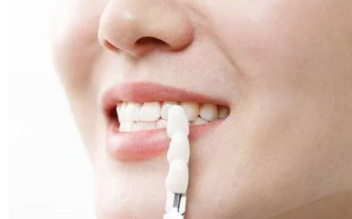 五、去除补牙材料后的注意事项