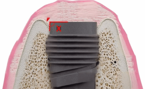 二、空腹拔牙的风险，不止低血糖这么简单