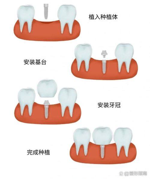 温州瑞安杨晓庆口腔地址电话及营业时间