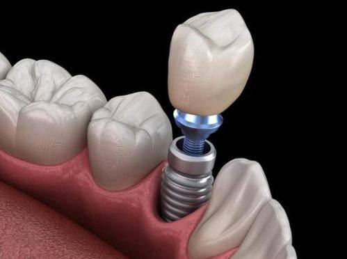 温州瑞安杨晓庆口腔价格表