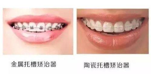 景德镇珠山区康齿口腔门诊部地址电话及营业时间