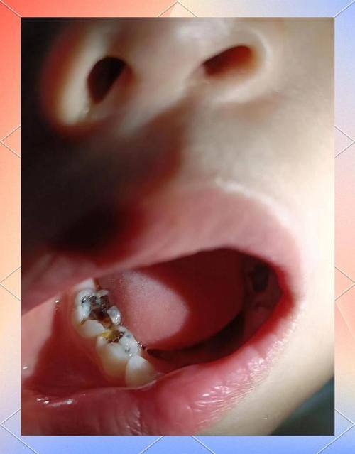 淮安美齿口腔擅长项目: