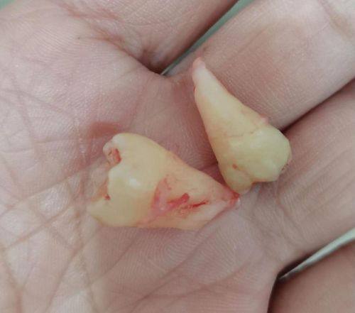 温州瑞安杨晓庆口腔预约挂号方式