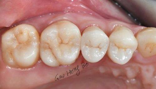 淮安美齿口腔预约挂号方式