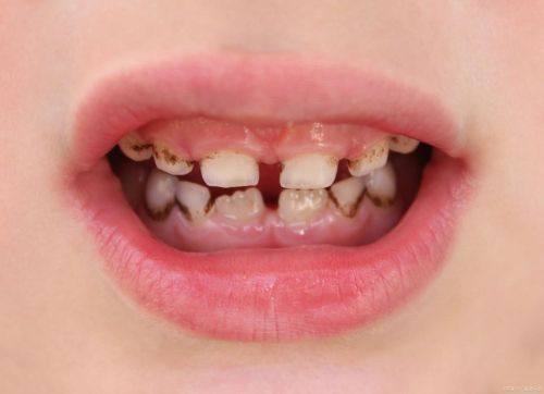 景德镇珠山区康齿口腔门诊部预约挂号方式