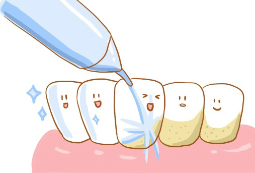 五、这些细节，也会影响拔牙方案的确定