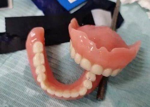 牙齿拔了可以马上种植牙吗？即刻种植有条件，并非人人都能当天种牙