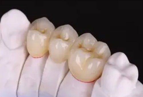 空腹血糖9可以拔牙吗？含9.2/孕妇疑问，不建议先控糖附拔牙注意事项