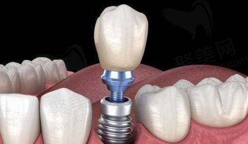 重庆涪陵泽优美即适口腔价格表：