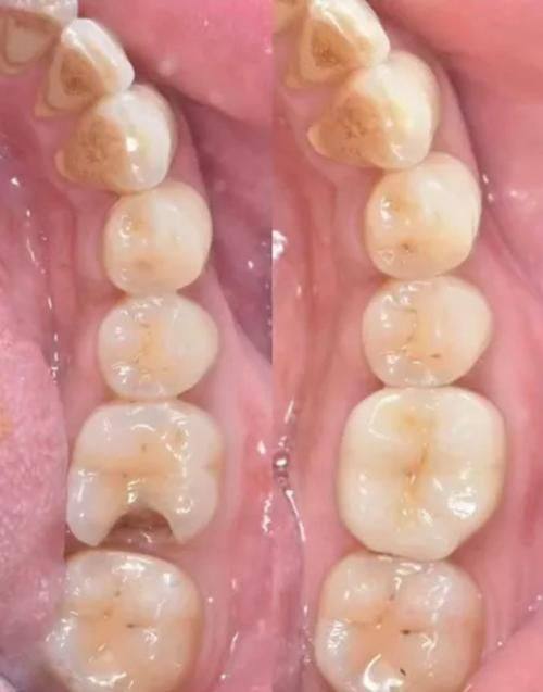 绍兴上虞厚德口腔门诊部价格表：