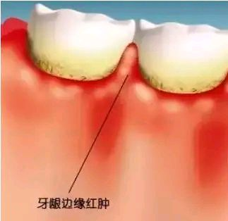 四、空腹血糖9的孕妇能拔牙吗