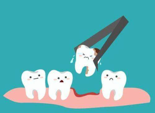 四、根管治疗会用到金属材料吗?金属桩核的适用场景