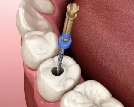 四、早上拔牙前吃早餐的其他注意事项