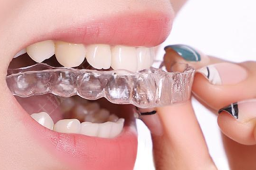 四、医生技术对是否拔牙的关键作用