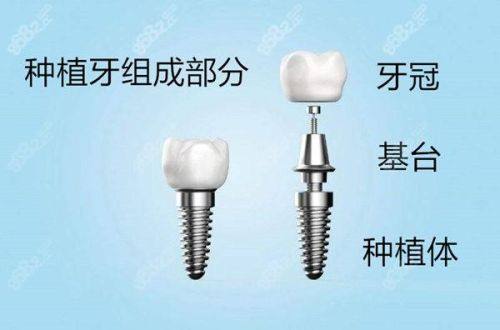 湖州德清沈晓波口腔诊所价格表：