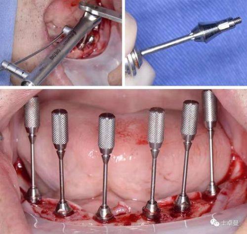 鄂尔多斯瞿英楠口腔诊所医生名单及擅长领域：
