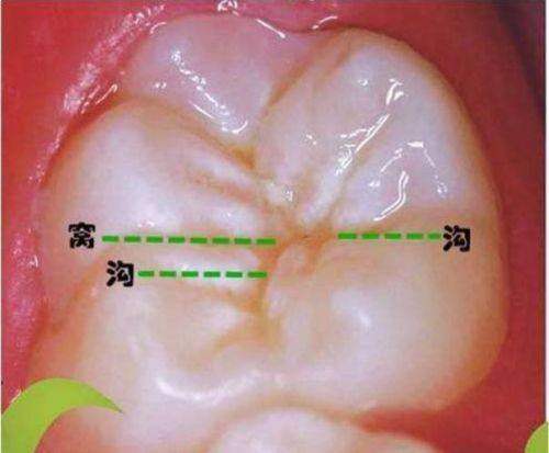 宁波蓝野口腔怎么样?