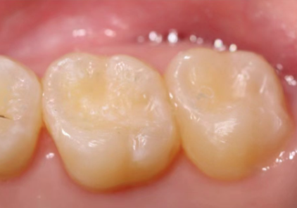 鄂尔多斯瞿英楠口腔诊所预约挂号方式：