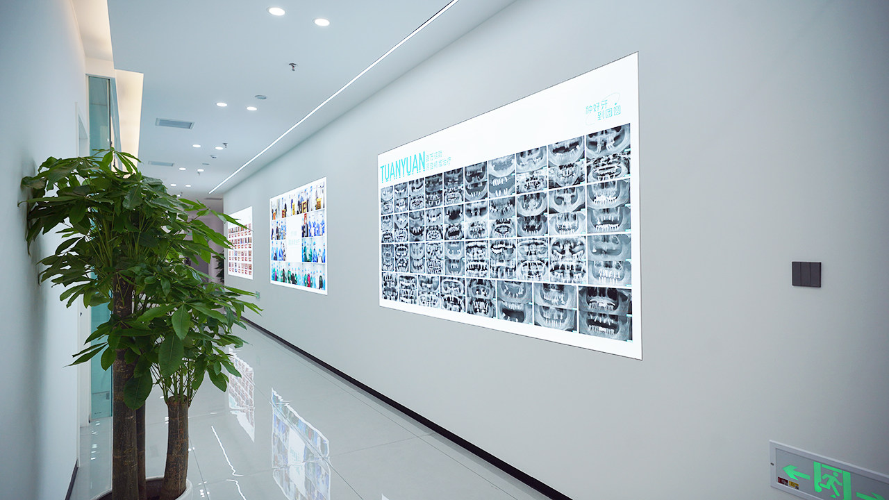 在成都团圆口腔种牙顺带洗牙，遵循护牙建议，口腔清爽啃硬食完全无压力