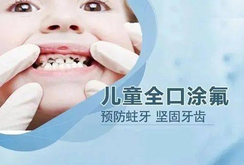 四、家长常见误区:儿童洗牙的“坏处”其实是认知偏差