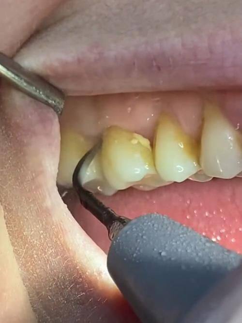 台州晶美口腔擅长项目：