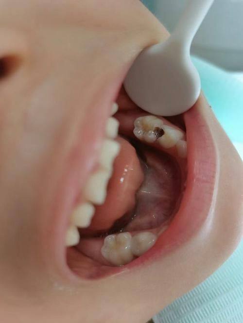 上海舜川口腔价格表: