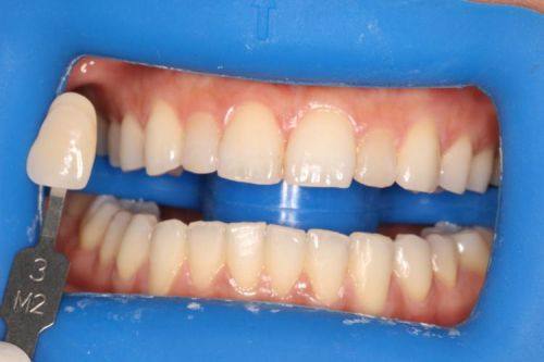 江西赣州金赣口腔医院医生名单及擅长领域：