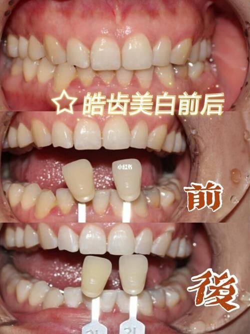 上海舜川口腔口碑评价: