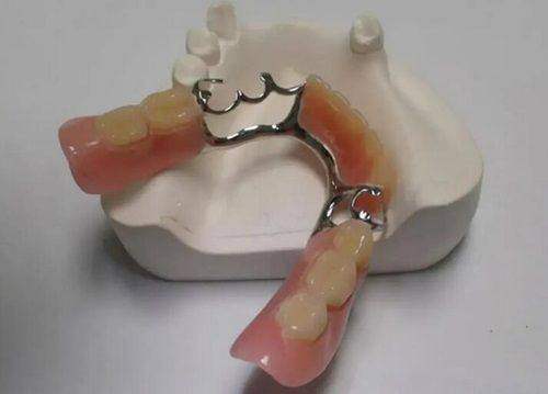 四、超声波洁牙VS喷砂洗牙：互补大于竞争，按需搭配