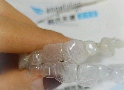 二、智齿坏了一个洞是补还是拔掉