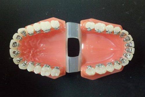 五、超声波洁牙的细节升级：抛光与套餐怎么选