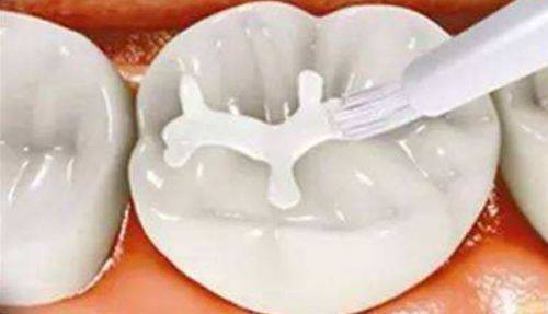 伊尔意口腔门诊部擅长项目：