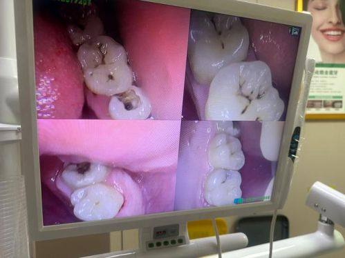 广西防城港牙元素口腔怎么样？