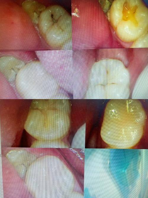 张家港杨舍西城奥斯卡口腔门诊部地址电话及营业时间: