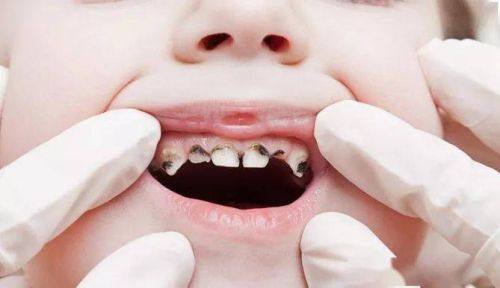 江西省儿童医院口腔科怎么样？